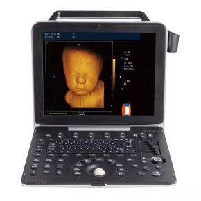 Portable ultrasound machine real time 4D color echo doppler DW-P6